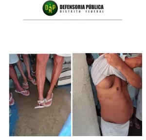 “Prisão humanitária”: Justiça deixa morrer 1700 detentos idosos e doentes por ano 4 “Prisão humanitária”: Justiça deixa morrer 1700 detentos idosos e doentes por ano