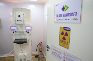 Lei garante mamografia pelo SUS para mulheres a partir dos 40 anos