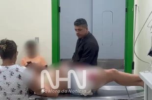 Violência contra a mulher: ex-marido não aceita término do relacionamento e agride ex-companheira