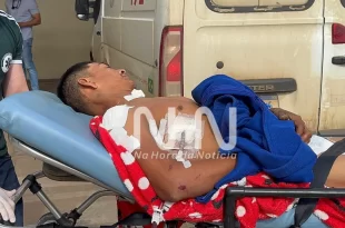 Violência no Acre: homem é agredido e baleado durante ataque de facção em via pública
