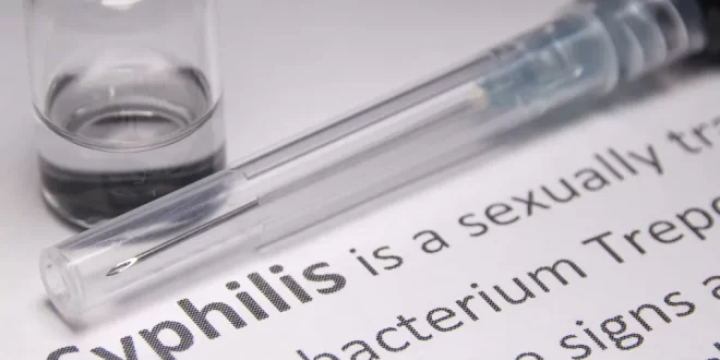 Problema antigo: pesquisa acha DNA de bactéria da sífilis com mais de 5.000 anos