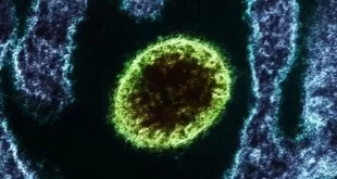 Nipah: vírus mais letal que o coronavírus, sem vacina e com taxa de mortalidade de até 75%
