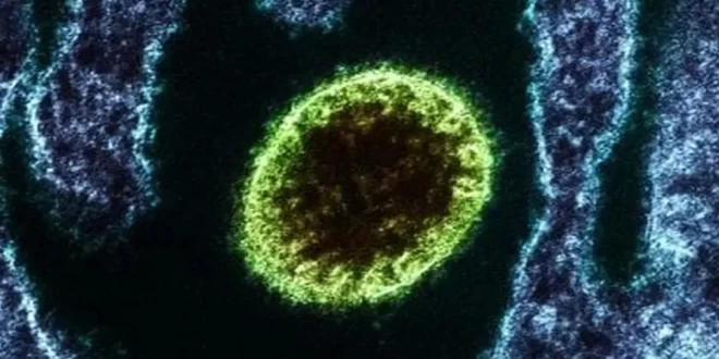 Nipah: vírus mais letal que o coronavírus, sem vacina e com taxa de mortalidade de até 75%