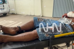 Violência em Rio Branco: monitorado por tornozeleira eletrônica é agredido a golpes de terçado e ripadas