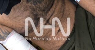 Violência em Rio Branco: ferido a golpes de terçado pede ajuda em praça pública