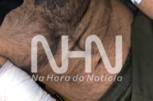 Violência em Rio Branco: ferido a golpes de terçado pede ajuda em praça pública