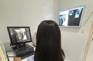 Porto Walter e Marechal Thaumaturgo recebem modernização no serviço de raio-X para agilizar diagnósticos no interior
