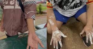 Extrema-direita invade calourada da Unicamp e agride estudantes