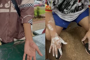 Extrema-direita invade calourada da Unicamp e agride estudantes