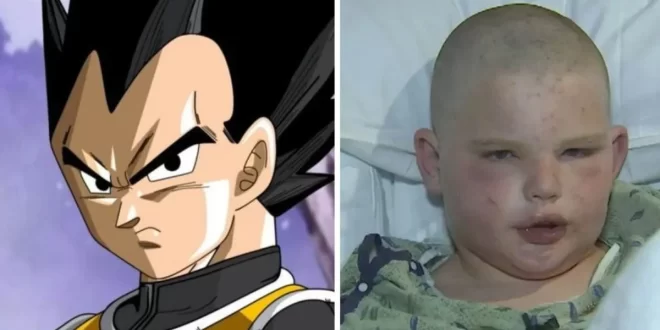Menino imita personagem de ‘Dragon ball’ para sobreviver a ataque de abelhas