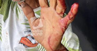 Violência em Rio Branco: Idoso é esfaqueado e roubado por detento monitorado por tornozeleira no centro