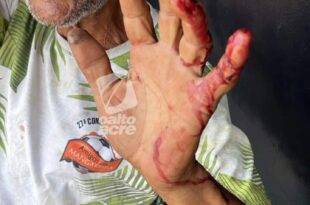 Violência em Rio Branco: Idoso é esfaqueado e roubado por detento monitorado por tornozeleira no centro