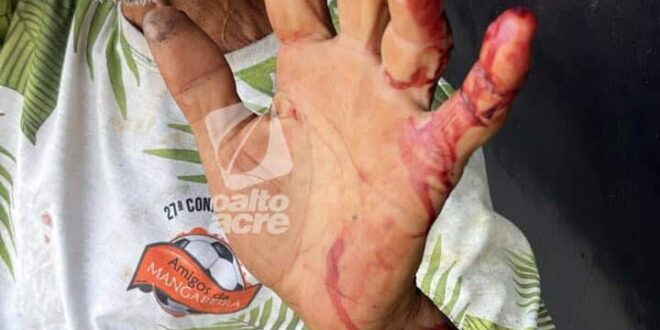 Violência em Rio Branco: Idoso é esfaqueado e roubado por detento monitorado por tornozeleira no centro