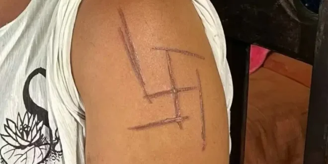 Mulher é torturada por patrões e tem suástica marcada no braço