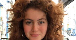 Garota de 20 anos morre após meningite causar sangramento nos olhos