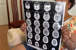 Alerta: golpe usa exames médicos para furtar dados bancários
