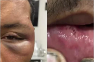 Violência política: homem é espancado em bar no MT após revelar que é petista