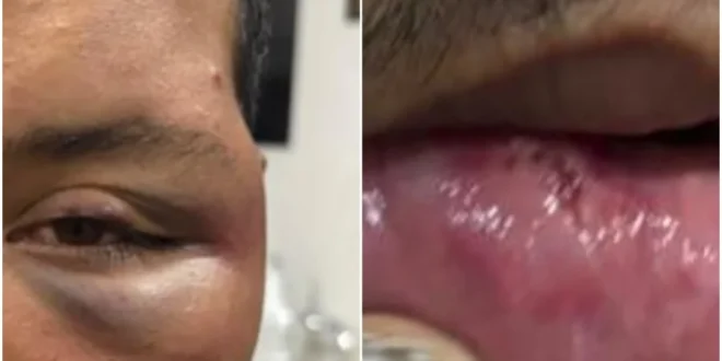 Violência política: homem é espancado em bar no MT após revelar que é petista