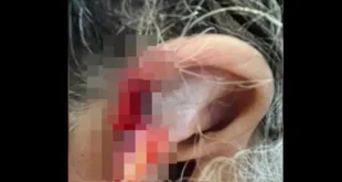 Mundo cão: neto espanca e come orelha da avó de 73 anos