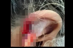Mundo cão: neto espanca e come orelha da avó de 73 anos