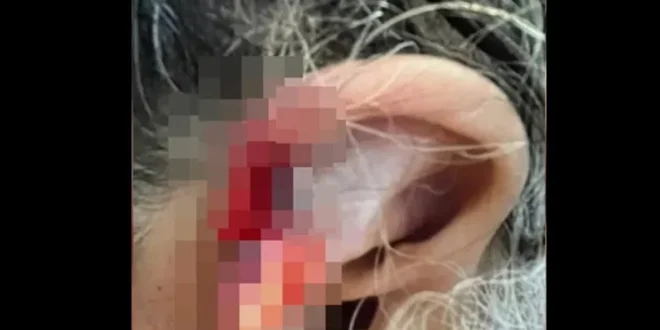 Mundo cão: neto espanca e come orelha da avó de 73 anos