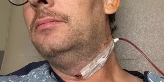 Ator descobre câncer causado por vírus transmitido no sexo