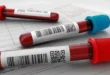 Exame de sangue detecta mais de 50 tipos de câncer em estágios iniciais