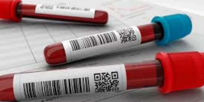 Exame de sangue detecta mais de 50 tipos de câncer em estágios iniciais