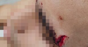 Dupla arma emboscada para assaltar e deixa vítima ferida