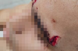 Dupla arma emboscada para assaltar e deixa vítima ferida