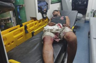 Tentativa de roubo no SAMU acaba com um preso e outro baleado