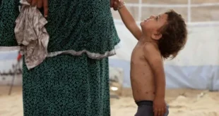Catapora se espalha pelos superlotados acampamentos de deslocados em Gaza