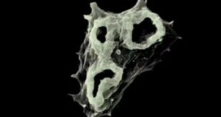 Mudanças climáticas: favorecida pelo aquecimento das águas ameba comedora de cérebro se espalha pelo mundo
