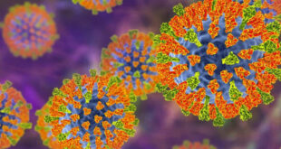 Alerta: baixa cobertura vacinal aumenta risco de novos surtos de sarampo no Brasil