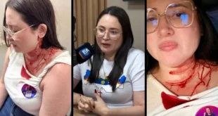 Violência Política: candidata do PSOL é atacada a pedradas