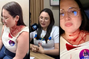 Violência Política: candidata do PSOL é atacada a pedradas