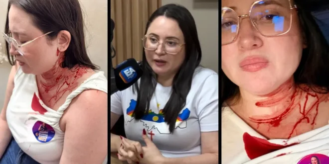 Violência Política: candidata do PSOL é atacada a pedradas