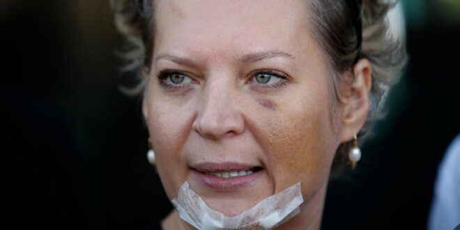 Mandou matar: Joyce Hasselmann diz que Jair Bolsonaro foi o mandante das agressões que sofreu